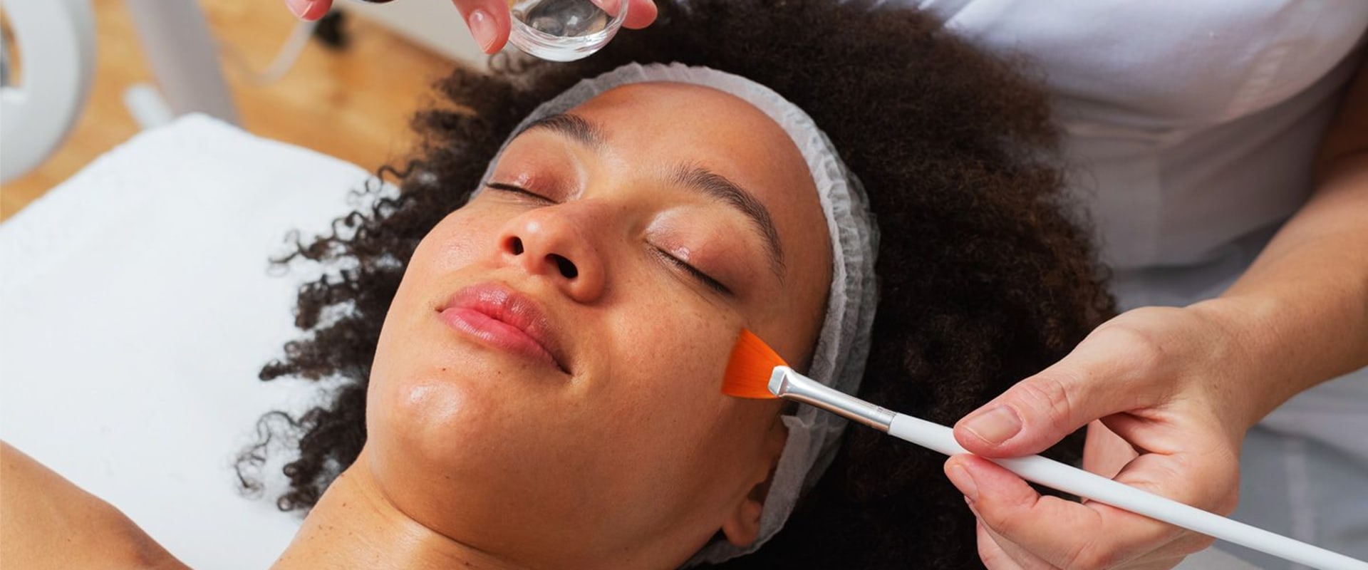 Everything You Need to Know About Chemical Peels for Exfoliation and Acne Scarring