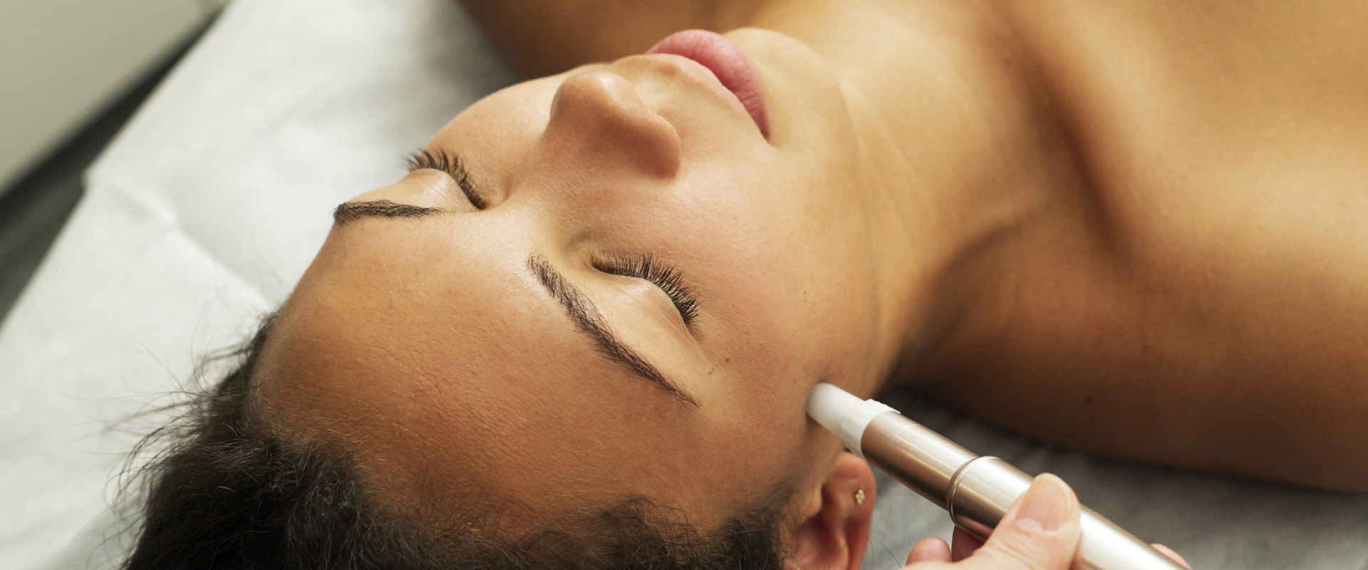 Improving Skin Texture and Tone with Microdermabrasion