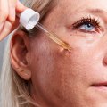 Retinoids: The Ultimate Solution for Reducing Fine Lines and Wrinkles