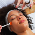 Everything You Need to Know About Chemical Peels for Exfoliation and Acne Scarring