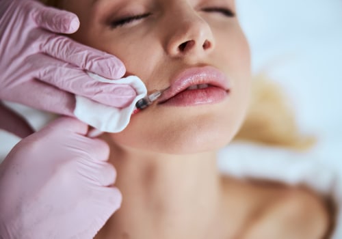 Combining Botox and Fillers for Optimal Results