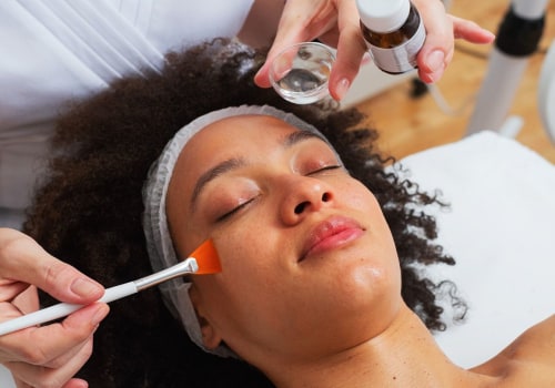 Everything You Need to Know About Chemical Peels for Exfoliation and Acne Scarring