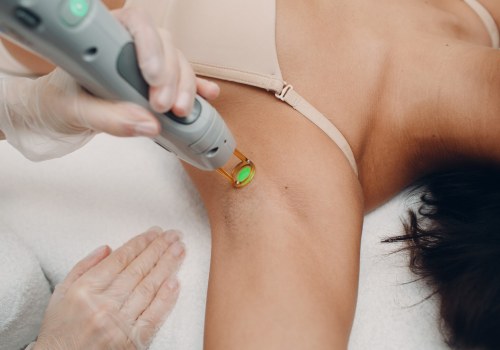 Benefits of Laser Hair Removal for Long-Term Hair Reduction in Glasgow